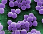 Staphylococcus_aureus_VISA_2