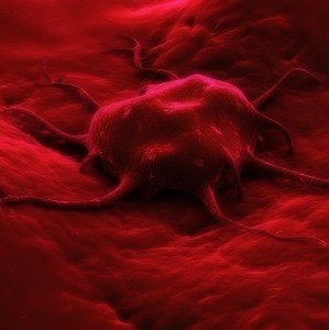 Cancer cell_iStock Photo
