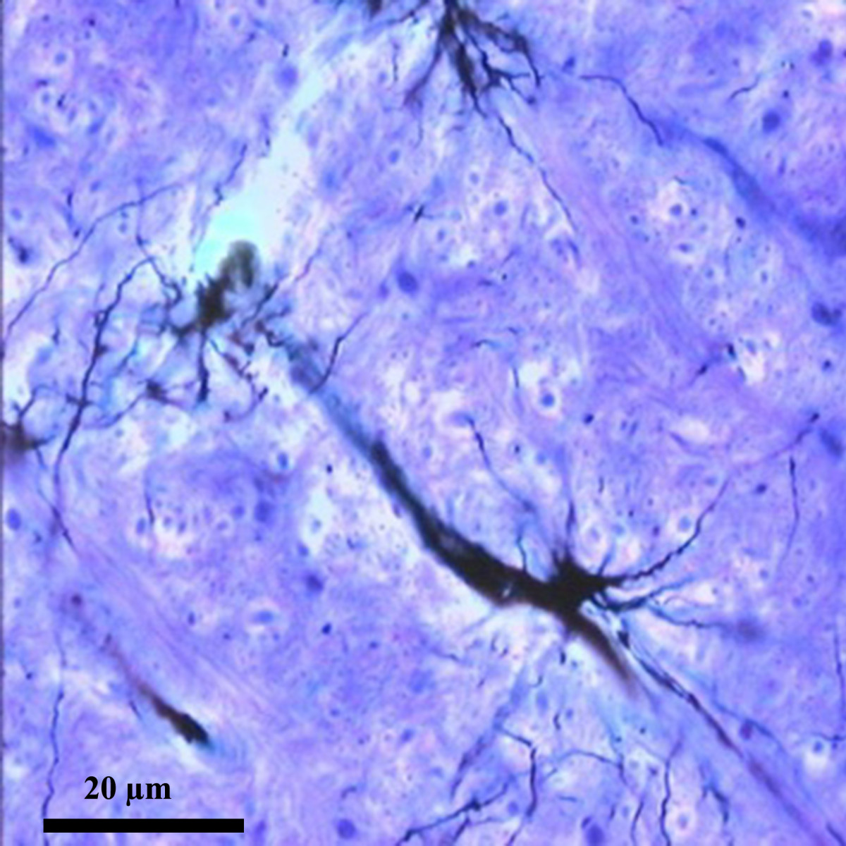 Protoplasmic astrocyte proximal to a blood vessel