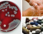 antimicrobial quiz
