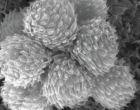 SEM image of colony forming cells of Synura conopea