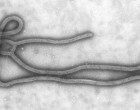 Ebola_Virus_TEM_PHIL_1832_lores (1)