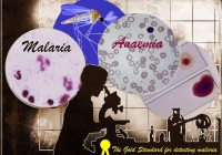 Malaria_anaemia_diagnostic_challenge