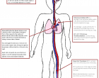 Thrombosis facts