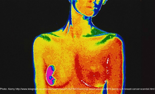 Breast cancer: Adipose tissue, a bulky neighbor causing trouble - On  Medicine