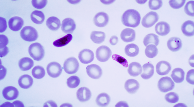 why malaria cause thrombocytopenia