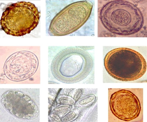 Helminth eggs from various species