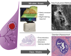 In order to diagnose breast cancer at the point of care, we have developed computerized tools to classify benign and malignant breast tissue. Our new evaluation method, which is illustrated at the top, can be completed in minutes to hours. Conversely, standard assessment, which is illustrated at the bottom, can take days to weeks for processing and diagnosis.