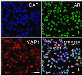 Co-immunofluorescence analysis of AR and YAP1 