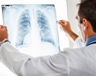 Doctor examining a lung