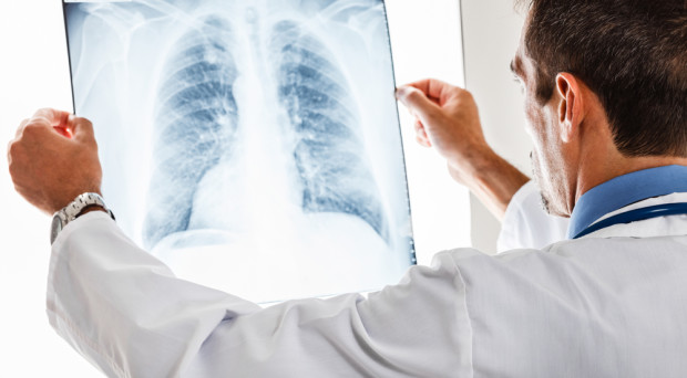 Doctor examining a lung