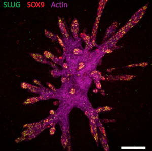The spotty cells at the tips of branches are leader stem cells, that express special proteins called Sox9 and Slug