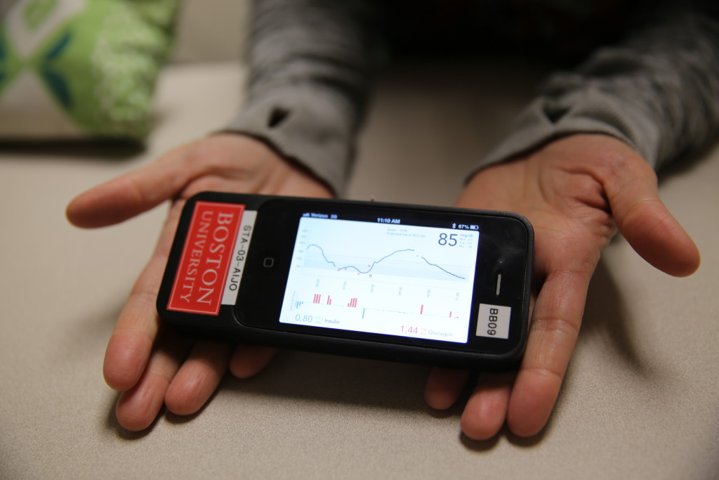 iPhone-based part of the "bionic pancreas", which monitors glucose levels and communicates with insulin and glucagon pumps to automatically dose the hormones into the bloodstream