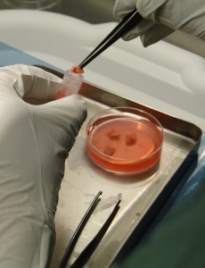 Placing ovarian tissue strips into the preserving solution