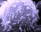 lymphocyte