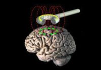 Transcranial_magnetic_stimulation
