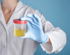 Doctor holding a urine sample_picscout 600by342