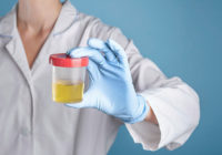 Doctor holding a urine sample_picscout 600by342