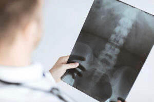 A doctor examining a hip X-ray